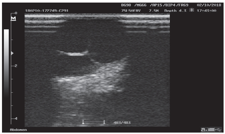 Ultrasonographic image of follicular cyst.