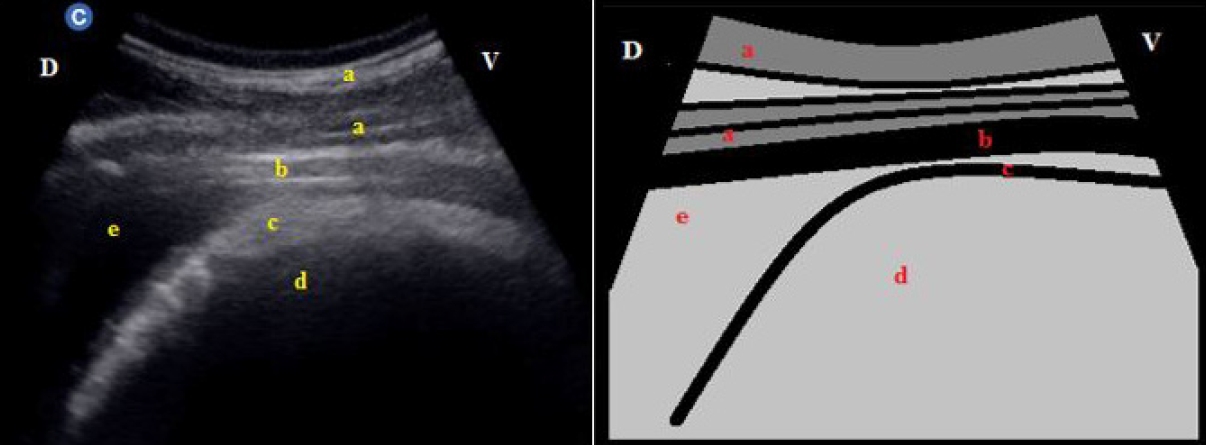 USG image showing reticulum wall appeared half-moon shape at 6th ICS on right lateral examination in a healthy buffalo of Group I. a) Abdominal wall; b) Diaphragm; c) Reticulum wall; d) Reticulum e) Liver. D: Dorsal; V: Ventral.