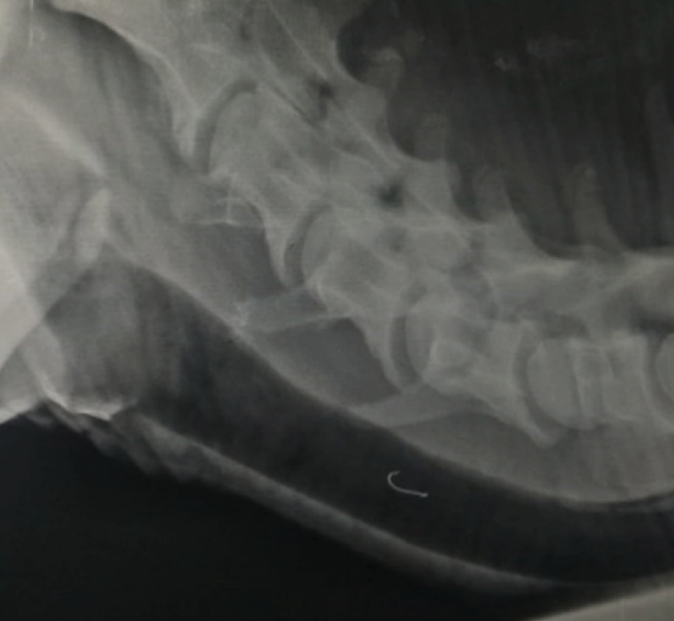 The lateral radiograph of neck revealed fishhook like metallic opacity