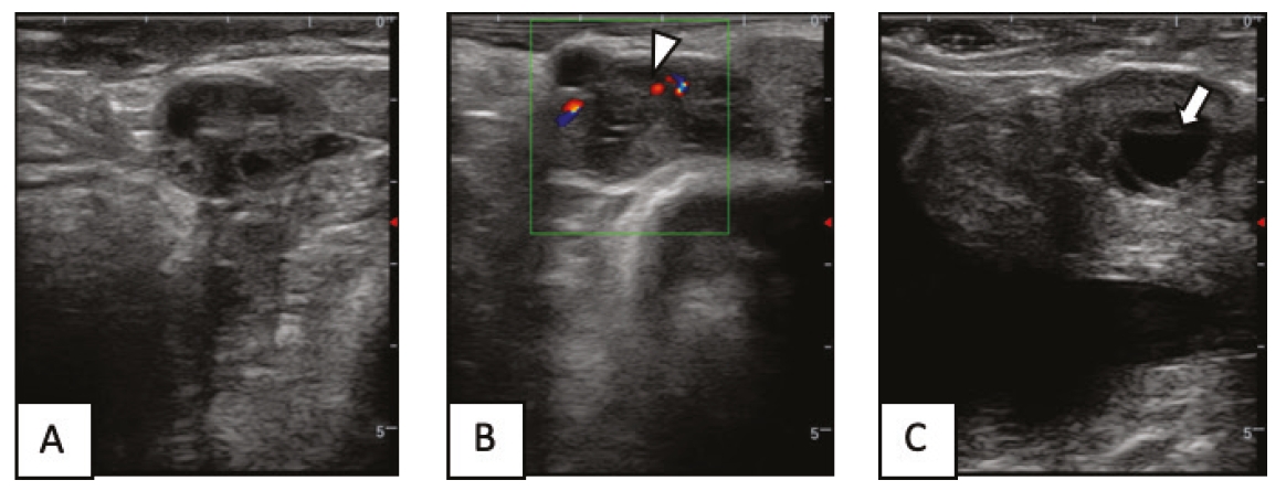 Representative ultrasonography of Thai swamp buffalo ovary (A), CL with open head arrow (B) and preovulatory follicle with open arrow (C).