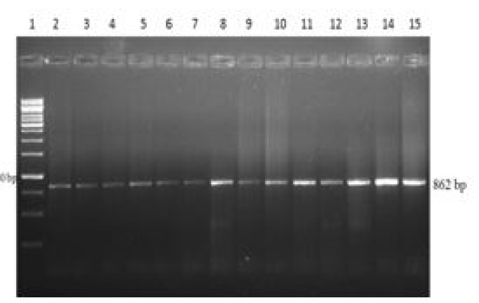 PCR amplification of PGLYRP-1 gene
