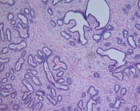 Mammary gland: Tubules and acini were lined with single or multilayers of cuboidal epithelial cells and separated with the bands of fibrous connective tissue. (H&E x 100).