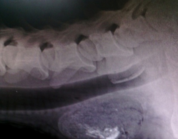 Oesophageal obstruction-complete.