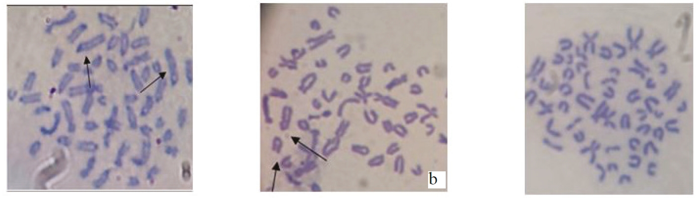 Metaphase plates of river buffalo (B. Bubalis) 2n = 50; a - female 2n = 48 (XX), arrows show X chromosome; b - male 2n = 48 (XY), arrows show X and Y chromosomes; c - clear morphology of five pairs of double-armed chromosomes (×1000).