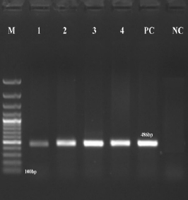 Agarose gel electrophoresis showing PCR product of uidA gene of Escherichia coli having 486 bp band. M: 100bp Marker, 1to4: Positive-samples, PC: Positive- control, NC: Negative-control.