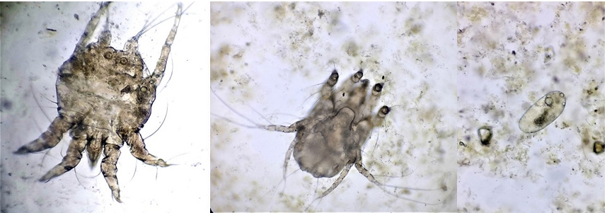Skin scrapping examination under 10X magnification (a) P. natalensis male ventral view (b) P. natalensis female ventral view (c) Egg of P. natalensis.