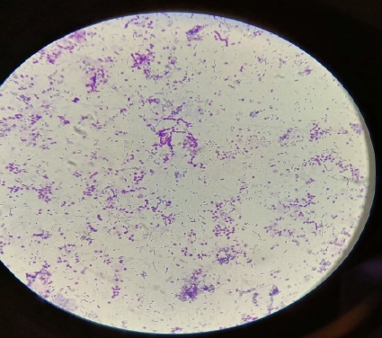 Microscopic view of skin scrapping soaked overnight and stained with Giemsa’s Stain showing branching filaments forming ribbons of sphericalor ovoid cocci.